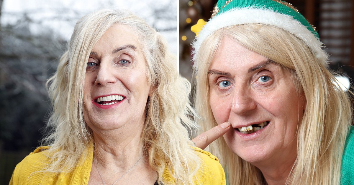Lotto winner spends $42,000 on new teeth that took nine hours to perfect